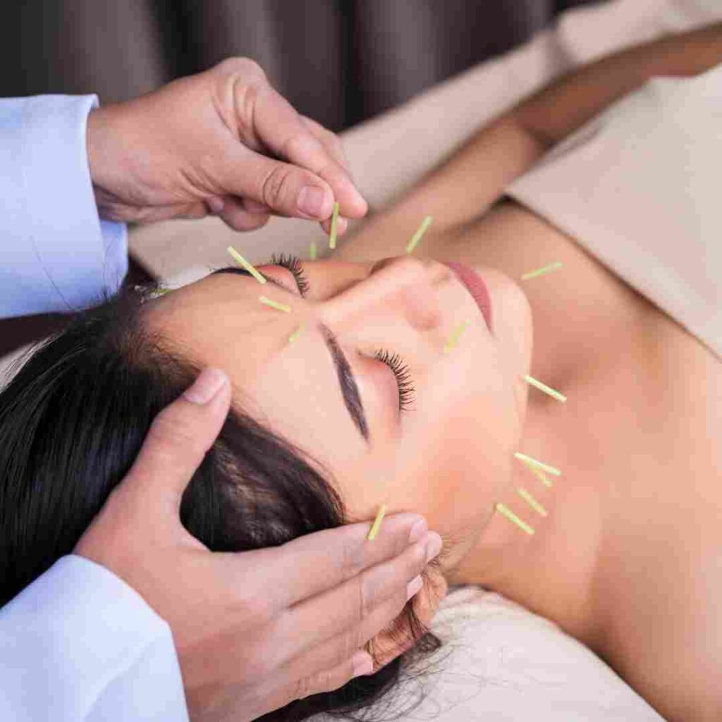 doctor doing acupuncture on face for healing body 